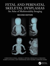 bokomslag Fetal and Perinatal Skeletal Dysplasias