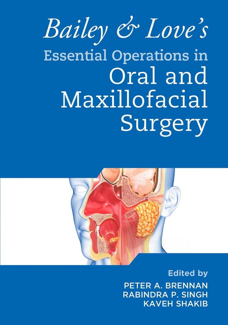Peter A. Brennan, Rabindra Singh, Kaveh Shakib, UK) Brennan, Peter A. (Department of Oral and Maxillofacial Surgery, Queen Alexandra Hospital, Portsmouth - Bailey & Love's Essential Operations in Oral & Maxillofacial Surgery, Häftad