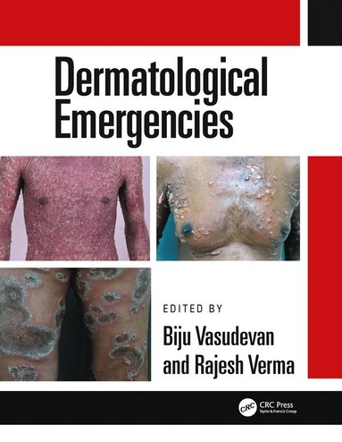 bokomslag Dermatological Emergencies