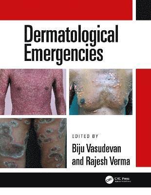 Dermatological Emergencies 1