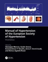 bokomslag Manual of Hypertension of the European Society of Hypertension, Third Edition