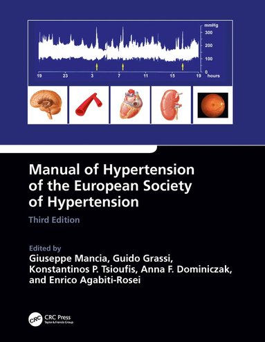 bokomslag Manual of Hypertension of the European Society of Hypertension, Third Edition