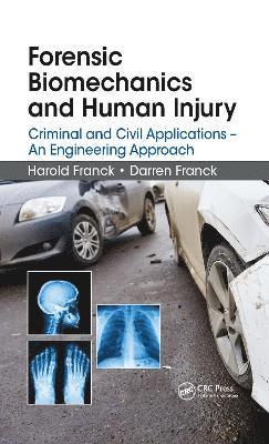 Forensic Biomechanics and Human Injury 1