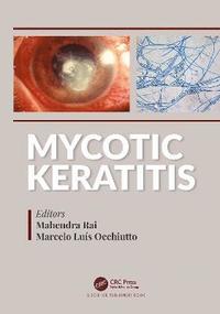 bokomslag Mycotic Keratitis