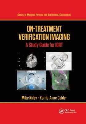 Mike Kirby, Kerrie-Anne Calder - On-Treatment Verification Imaging, Häftad