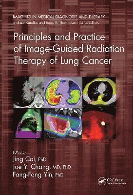 Jing Cai, Joe Y. Chang, Fang-Fang Yin, USA) Chang, Joe Y. (MD Anderson Cancer Center, Houston, TX - Principles and Practice of Image-Guided Radiation Therapy of Lung Cancer, Häftad