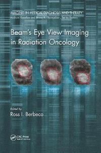 bokomslag Beam's Eye View Imaging in Radiation Oncology