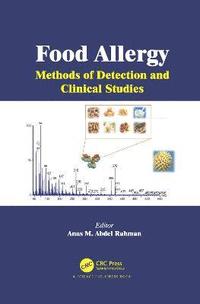 bokomslag Food Allergy