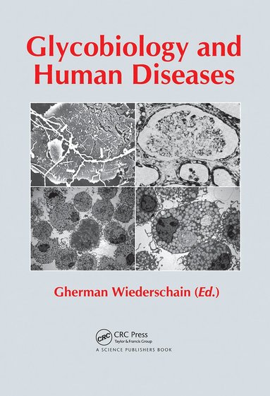 bokomslag Glycobiology and Human Diseases