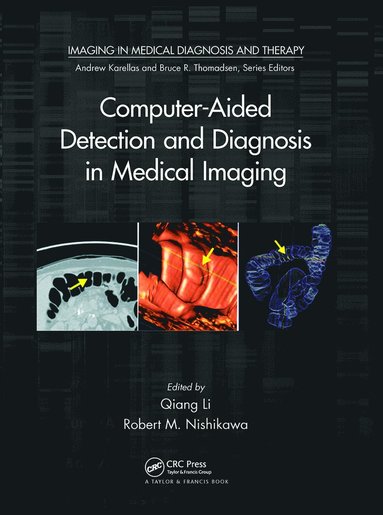 bokomslag Computer-Aided Detection and Diagnosis in Medical Imaging