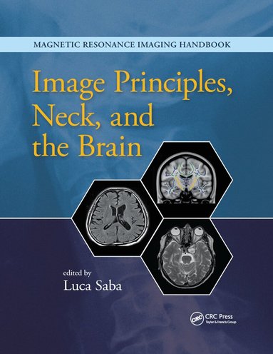 Luca Saba - Image Principles, Neck, and the Brain, Häftad