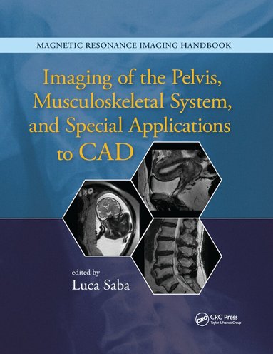 Luca Saba - Imaging of the Pelvis, Musculoskeletal System, and Special Applications to CAD, Häftad