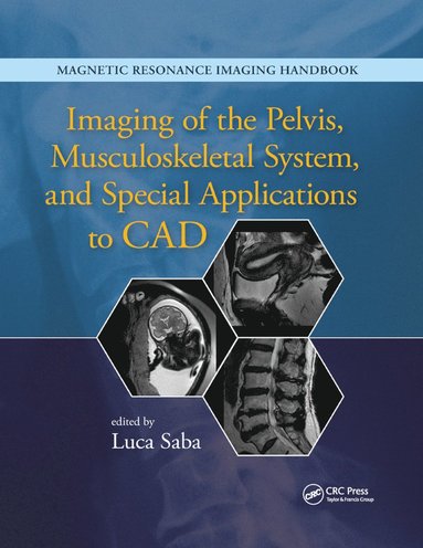 bokomslag Imaging of the Pelvis, Musculoskeletal System, and Special Applications to CAD