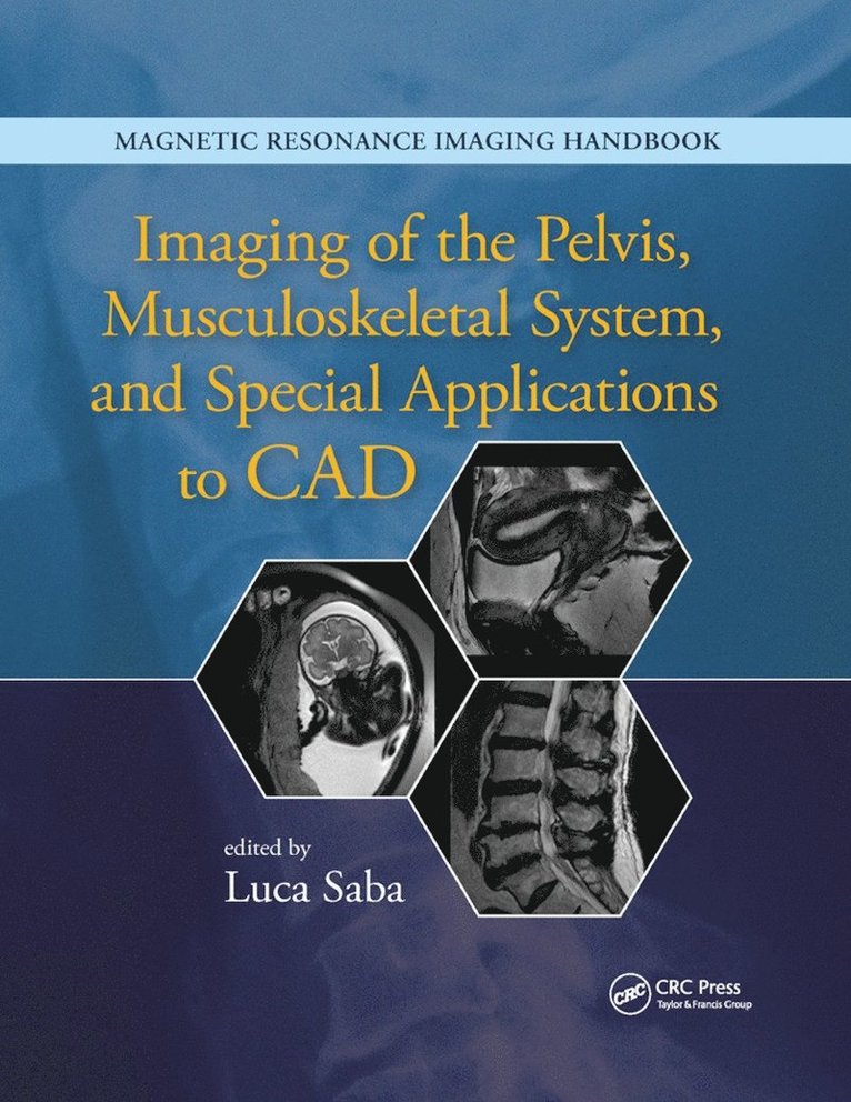 Imaging of the Pelvis, Musculoskeletal System, and Special Applications to CAD