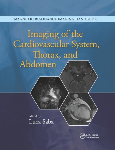 Luca Saba - Imaging of the Cardiovascular System, Thorax, and Abdomen, Häftad