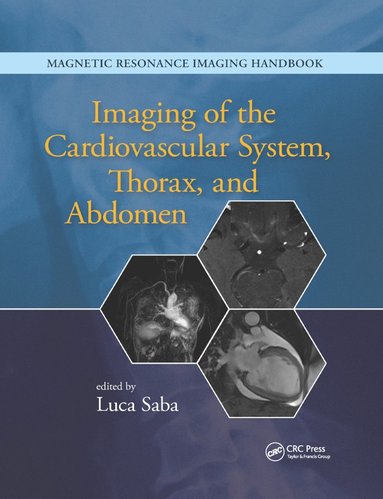 bokomslag Imaging of the Cardiovascular System, Thorax, and Abdomen