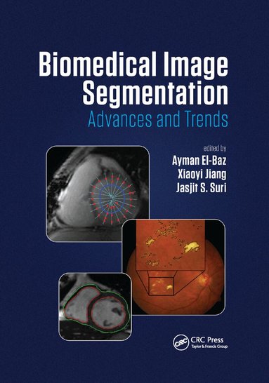 Ayman El-Baz, Xiaoyi Jiang, Jasjit S. Suri - Biomedical Image Segmentation, Häftad