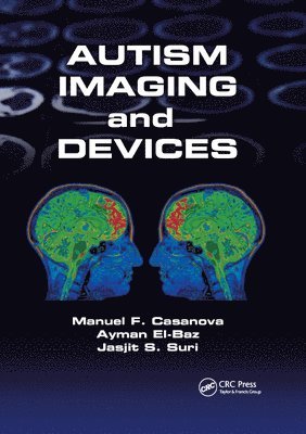 Manuel F. Casanova, Ayman El-Baz, Jasjit S. Suri, USA) Casanova, Manuel F. (University of Louisville, Kentucky, USA) El-Baz, Ayman (University of Louisville, Kentucky, USA) Suri, Jasjit S. (Global Biomedical Technologies, Inc., Roseville - Autism Imaging and Devices, Häftad