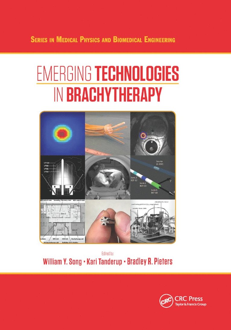 William Y. Song, Kari Tanderup, Bradley Pieters, Canada) Song, William Y. (Odette Cancer Centre, Sunnybrook Health Science Centre, Toronto, Aarhus University) Tanderup, Kari (Aarhus University Hospital - Emerging Technologies in Brachytherapy, Häftad