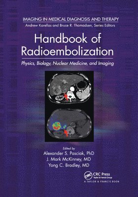 bokomslag Handbook of Radioembolization