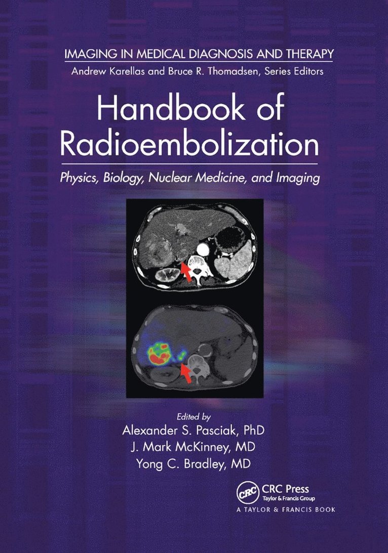 Alexander S. Pasciak, PhD., Yong Bradley, MD., J. Mark McKinney, MD., USA) Pasciak, PhD., Alexander S. (University of Tennessee Medical Center, Knoxville, USA) Bradley, MD., Yong (University of Tennessee, Graduate School of Medicine, Knoxville, USA) McKinney, MD., J. Mark (Mayo Clinic, Jacksonville, Florida, Alexander S. Pasciak Phd, Yong Bradley MD - Handbook of Radioembolization, Häftad