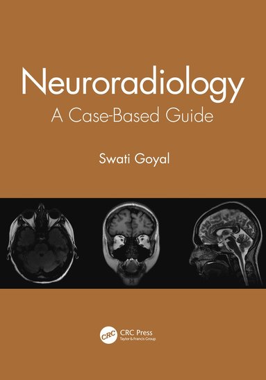 bokomslag Neuroradiology