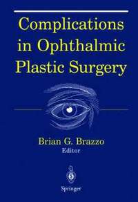 bokomslag Complications in Ophthalmic Plastic Surgery