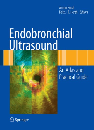 Armin Ernst, Felix JF Herth - Endobronchial Ultrasound, Inbunden