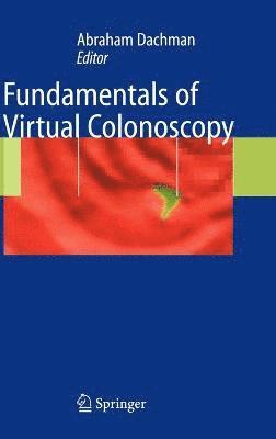 Fundamentals of Virtual Colonoscopy 1