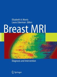 bokomslag Breast MRI