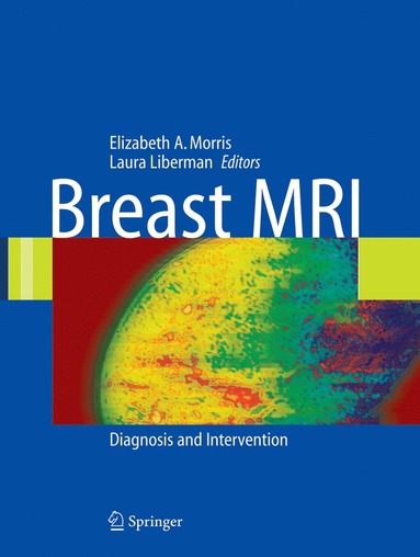 bokomslag Breast MRI