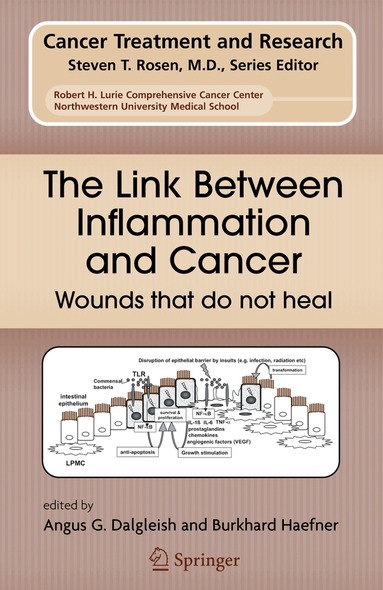 Angus G. Dalgleish, Burkhard Haefner - Link Between Inflammation and Cancer, Inbunden
