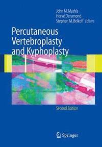 bokomslag Percutaneous Vertebroplasty and Kyphoplasty