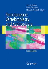 bokomslag Percutaneous Vertebroplasty and Kyphoplasty