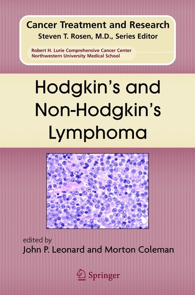 John P. Leonard, Morton Coleman - Hodgkin's and Non-Hodgkin's Lymphoma, Inbunden