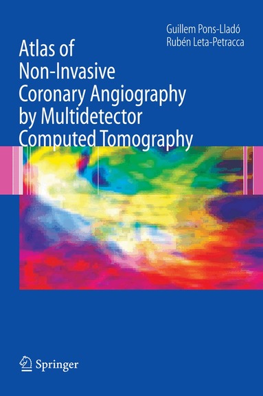 Guillem Pons-Llado, Ruben Leta-Petracca - Atlas of Non-Invasive Coronary Angiography by Multidetector Computed Tomography, Inbunden