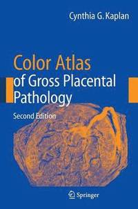 bokomslag Color Atlas of Gross Placental Pathology