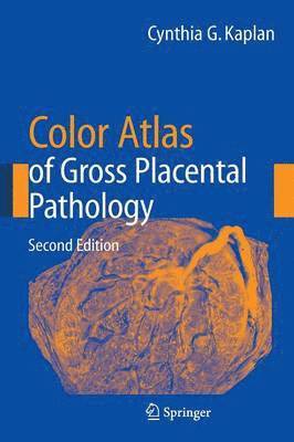 Cynthia G. Kaplan - Color Atlas of Gross Placental Pathology, Inbunden