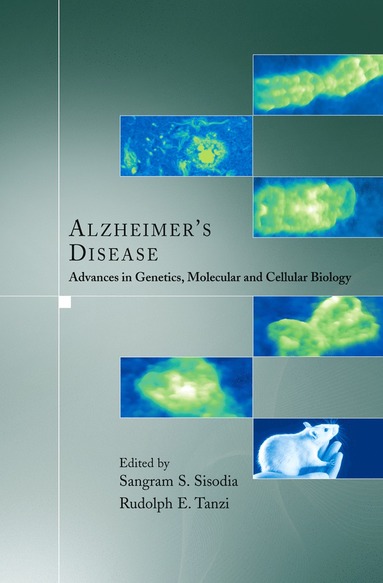 bokomslag Alzheimer's Disease