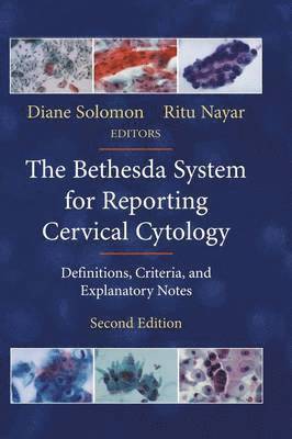 Bethesda System for Reporting Cervical Cytology