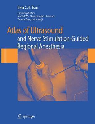 Atlas of Ultrasound- and Nerve Stimulation-Guided Regional Anesthesia 1