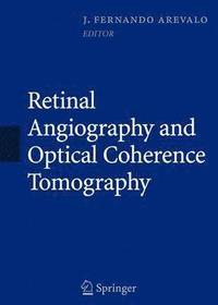 bokomslag Retinal Angiography and Optical Coherence Tomography