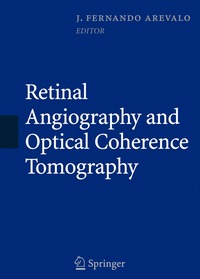 bokomslag Retinal Angiography and Optical Coherence Tomography