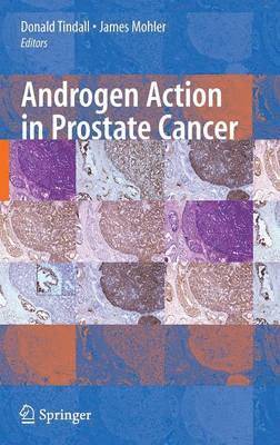 Androgen Action in Prostate Cancer 1