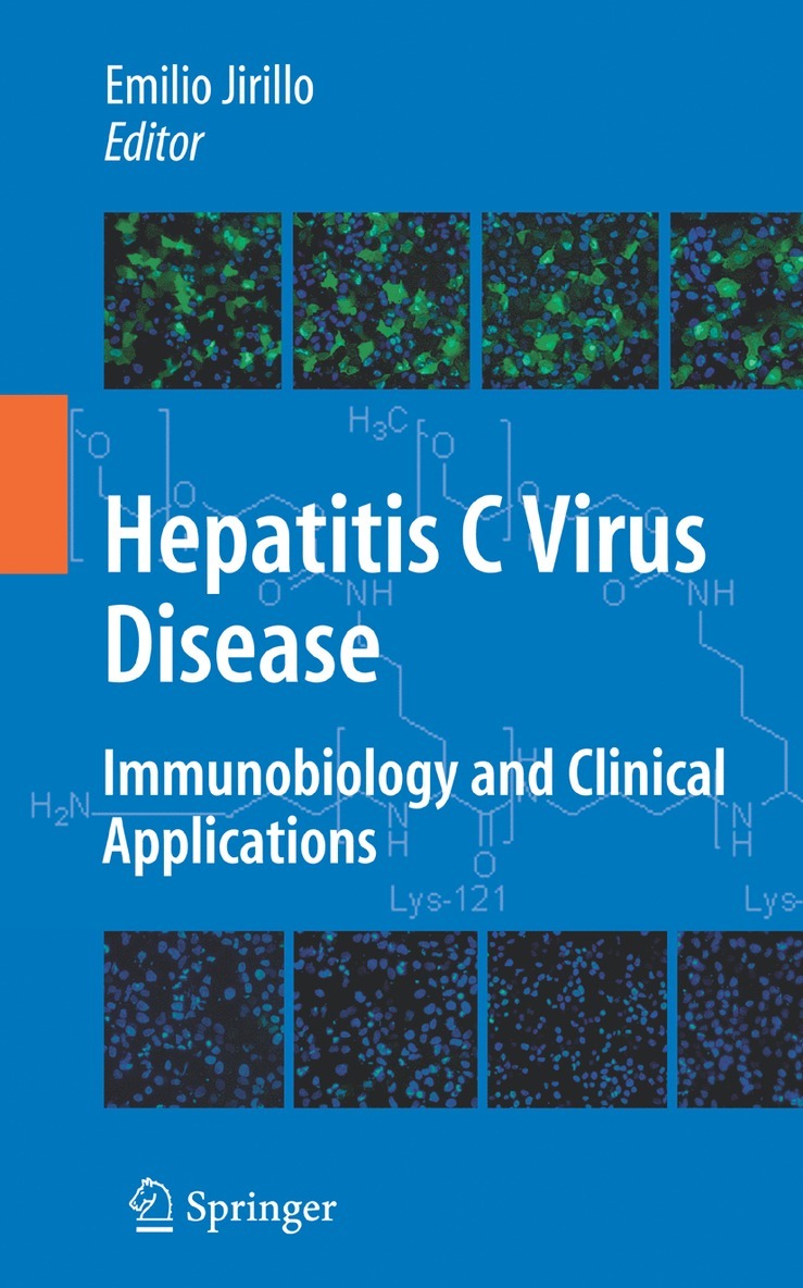 Emilio Jirillo - Hepatitis C Virus Disease, Inbunden