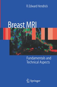 bokomslag Breast MRI