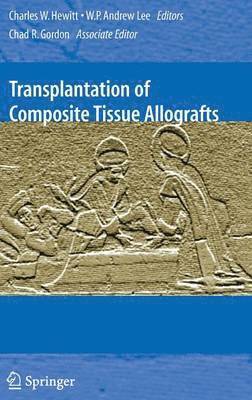 bokomslag Transplantation of Composite Tissue Allografts