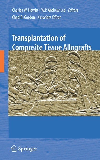 bokomslag Transplantation of Composite Tissue Allografts