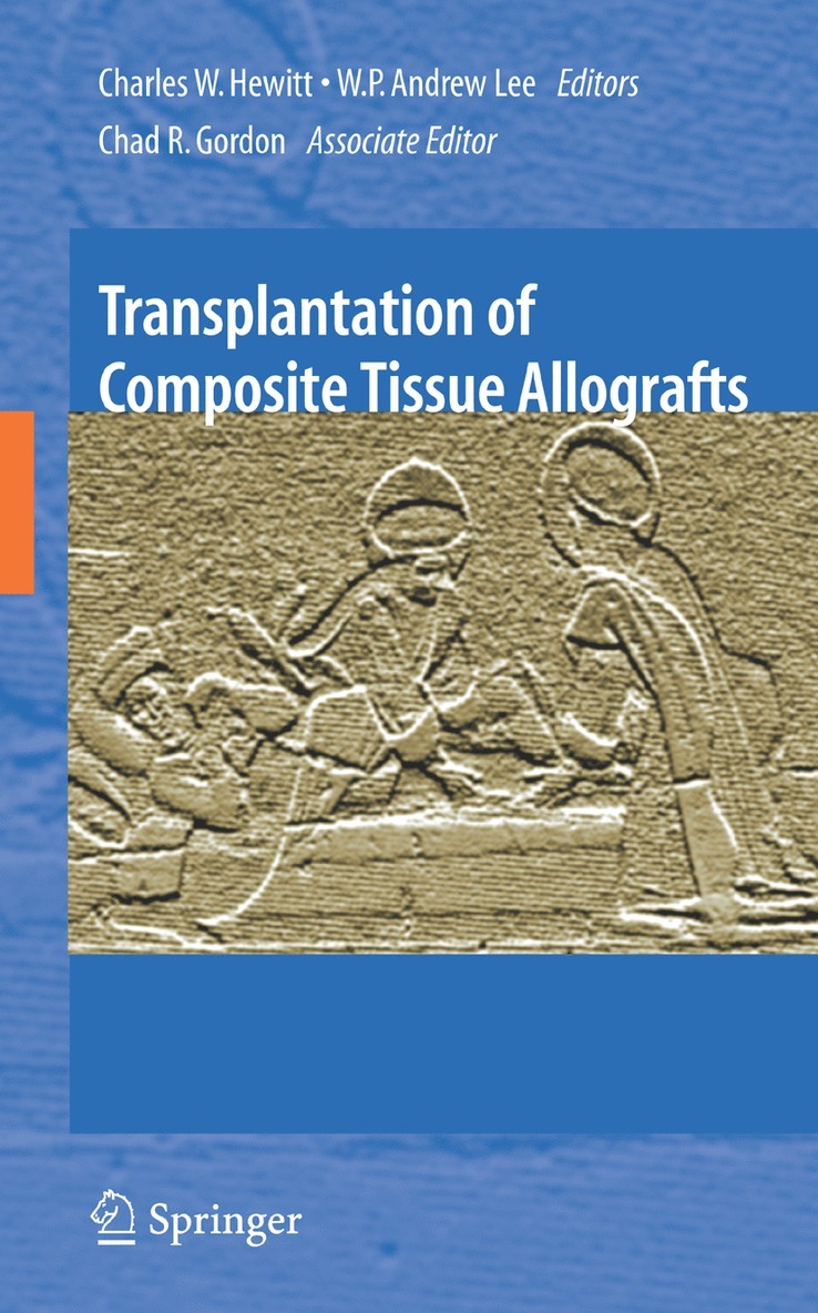Charles W. Hewitt, W.P. Andrew Lee, W. P. Andrew Lee - Transplantation of Composite Tissue Allografts, Inbunden