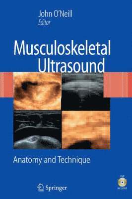 bokomslag Musculoskeletal Ultrasound